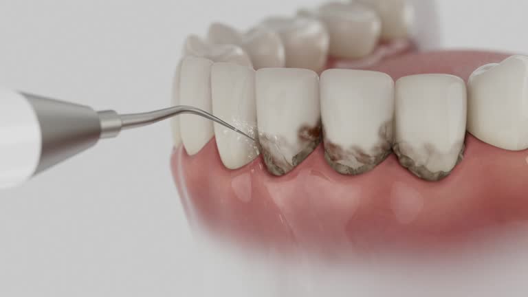 Trusted Teeth Whitening service in Goose Creek Village, VA - Dentist Open Now